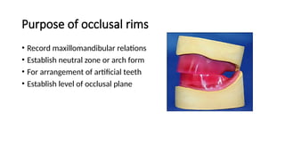 Oclusal Rim Prosthetics.pptx, occlusal rims and jaw relations | PPTX