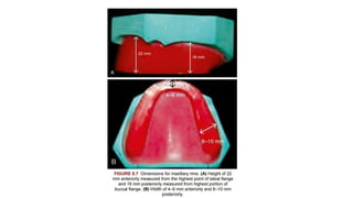 Occlusal Rim Inclinator Prosthetics.pptx, occlusal rims and jaw relations | PPTX