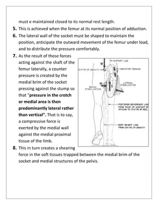 must e maintained closed to its normal rest length.
5. This is achieved when the femur at its normal position of adduction.
6. The lateral wall of the socket must be shaped to maintain the
position, anticipate the outward movement of the femur under load,
and to distribute the pressure comfortably.
7. As the result of these forces
acting against the shaft of the
femur laterally, a counter
pressure is created by the
medial brim of the socket
pressing against the stump so
that “pressure in the crotch
or medial area is then
predominantly lateral rather
than vertical”. That is to say,
a compressive force is
exerted by the medial wall
against the medial proximal
tissue of the limb.
8. This in turn creates a shearing
force in the soft tissues trapped between the medial brim of the
socket and medial structures of the pelvis.
 
