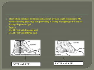  This belting simulates to flexors and assist in giving a slight resistance to MP
extension during preswing, thus preventing a feeling of dropping off of the toe
during this phase of gait.
 Types:-
1. SACH Foot with External keel
2. SACH Foot with Internal keel
INTERNAL KEEL EXTERNAL KEEL
 