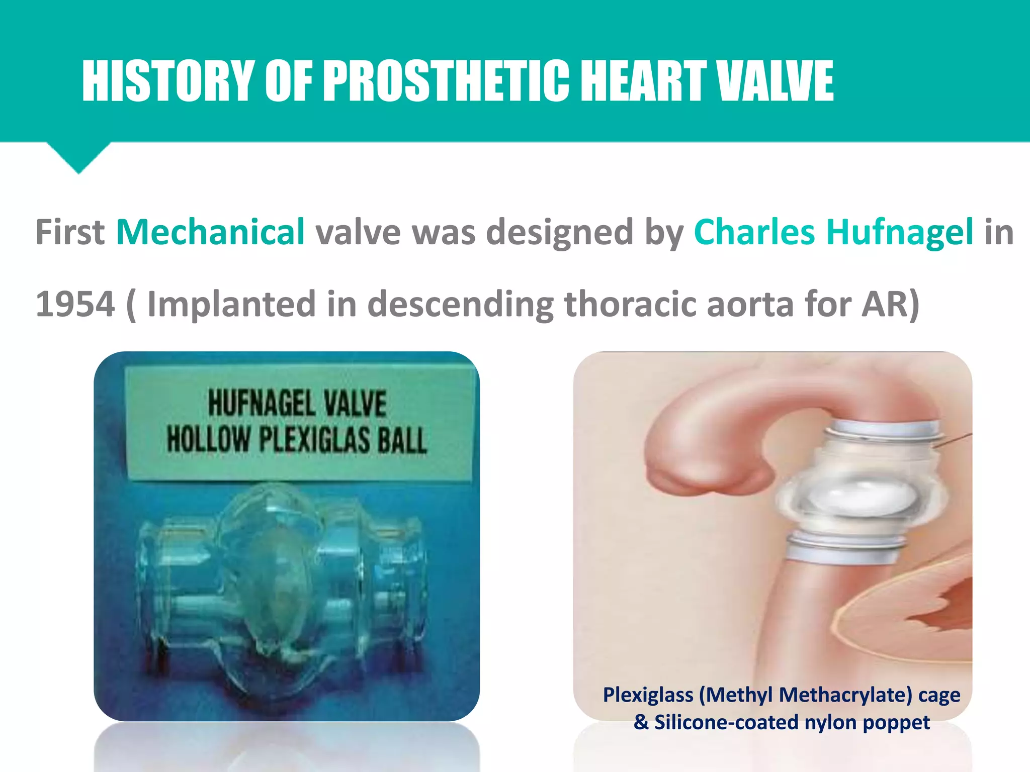 Prosthetic Heart Valves Types Physiology PPTX