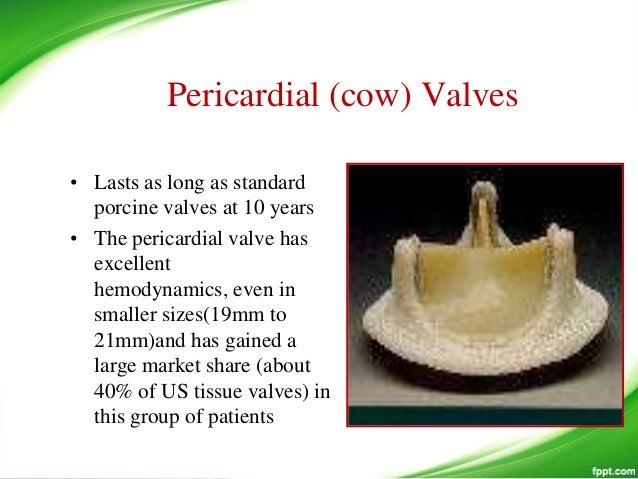 Prosthetic valves the past present and future i tammi raju