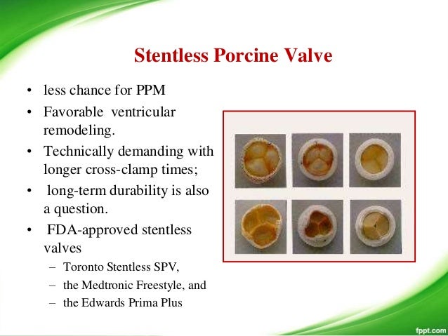 Prosthetic valves the past present and future i tammi raju