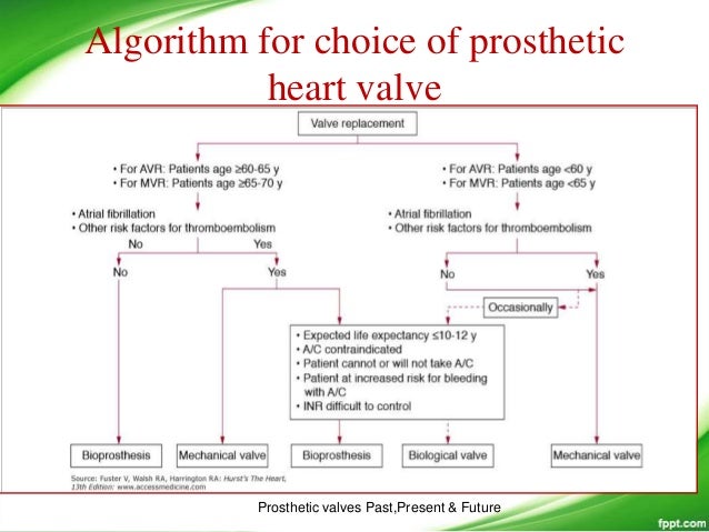 Prosthetic valves the past present and future i tammi raju