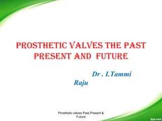 Prosthetic valves the past
present and future
Dr . I.Tammi
Raju
Prosthetic valves Past,Present &
Future
 