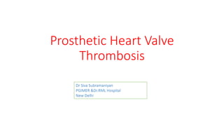 Prosthetic Heart Valve
Thrombosis
Dr Siva Subramaniyan
PGIMER &Dr.RML Hospital
New Delhi
 