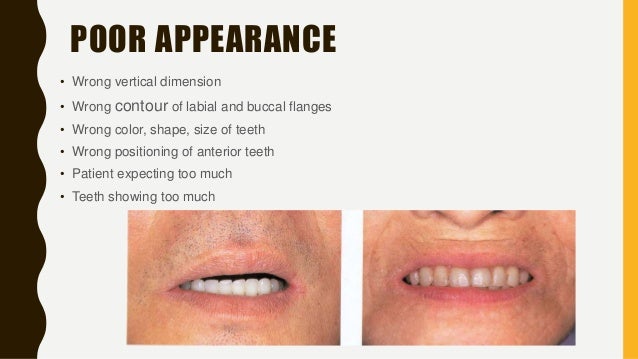 Dentures Wrong Color  . Calculate Linux 17.12.2 What Is Wrong With Color?
