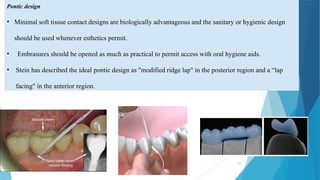 Prosthodontic-Periodontal interrelationship.pptx