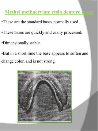 Methyl methacrylate resin denture bases
•These are the standard bases normally used.
•These bases are quickly and easily processed.
•Dimensionally stable.
•But in a short time the base appears to soften and
change color, and is not strong.
 