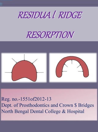 RESIDUAl RIDGE
RESORPTION
Reg. no.-1551of2012-13
Dept. of Prosthodontics and Crown $ Bridges
North Bengal Dental College & Hospital
 