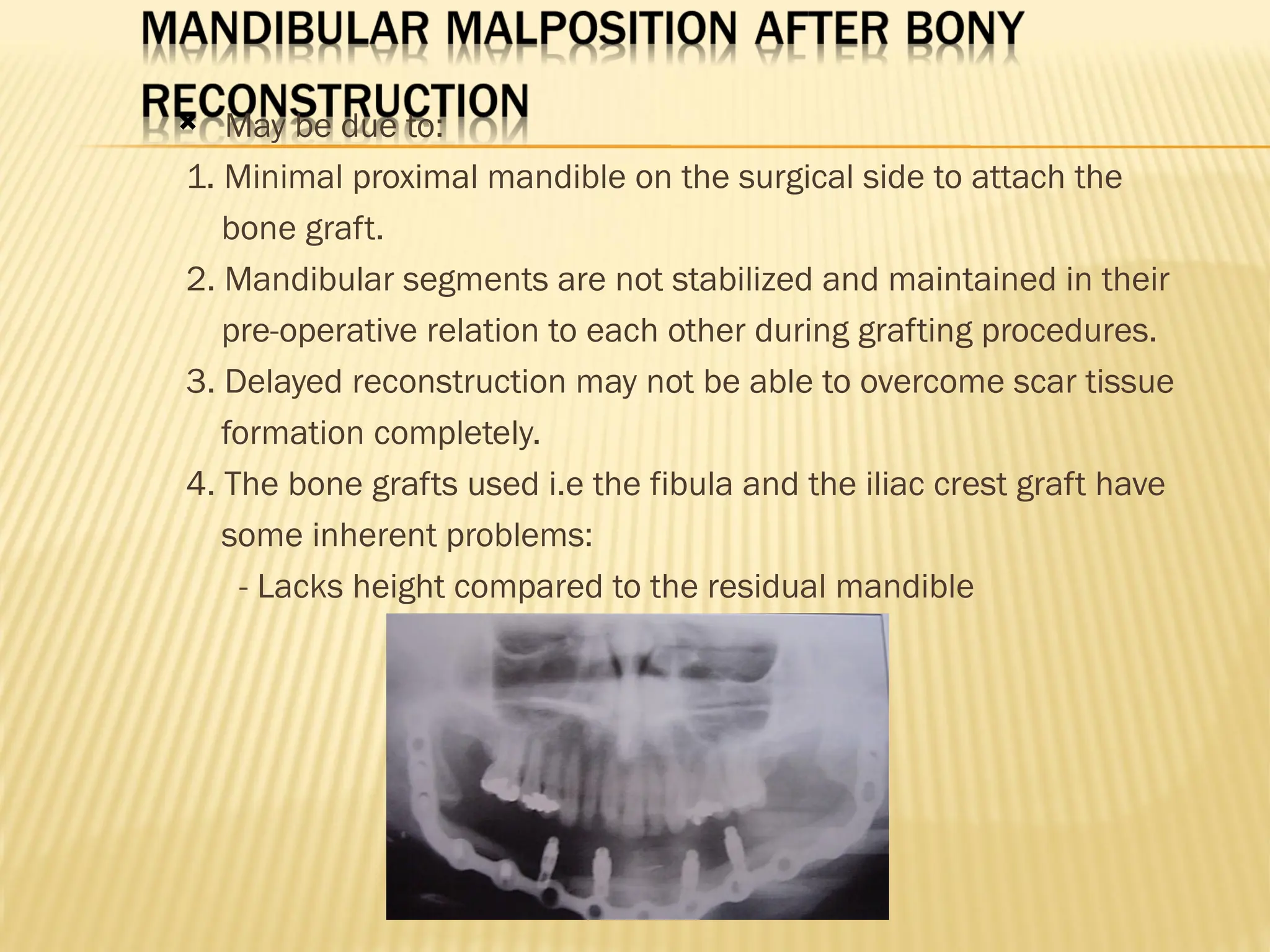  May be due to:
1. Minimal proximal mandible on the surgical side to attach the
bone graft.
2. Mandibular segments are not stabilized and maintained in their
pre-operative relation to each other during grafting procedures.
3. Delayed reconstruction may not be able to overcome scar tissue
formation completely.
4. The bone grafts used i.e the fibula and the iliac crest graft have
some inherent problems:
- Lacks height compared to the residual mandible
 
