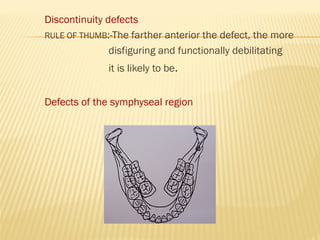 Discontinuity defects
RULE OF THUMB:-The farther anterior the defect, the more
disfiguring and functionally debilitating
it is likely to be.
Defects of the symphyseal region
 
