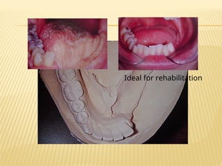 Ideal for rehabilitation
 