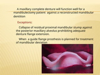 A maxillary complete denture will function well for a
mandibulectomy patient against a reconstructed mandibular
dentition
Exceptions:
Collapse of residual proximal mandibular stump against
the posterior maxillary alveolus prohibiting adequate
denture flange extension.
When a guide flange prosthesis is planned for treatment
of mandibular deviation
 
