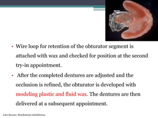Prosthodontic management of cleft lip and palate | PPTX