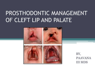 PROSTHODONTIC MANAGEMENT
OF CLEFT LIP AND PALATE
BY,
PAAVANA
III MDS
 