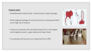 Prosthodontic management of endodontically treated teeth [autosaved] | PPTX
