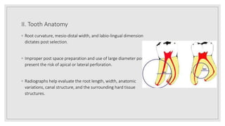Prosthodontic management of endodontically treated teeth [autosaved] | PPTX
