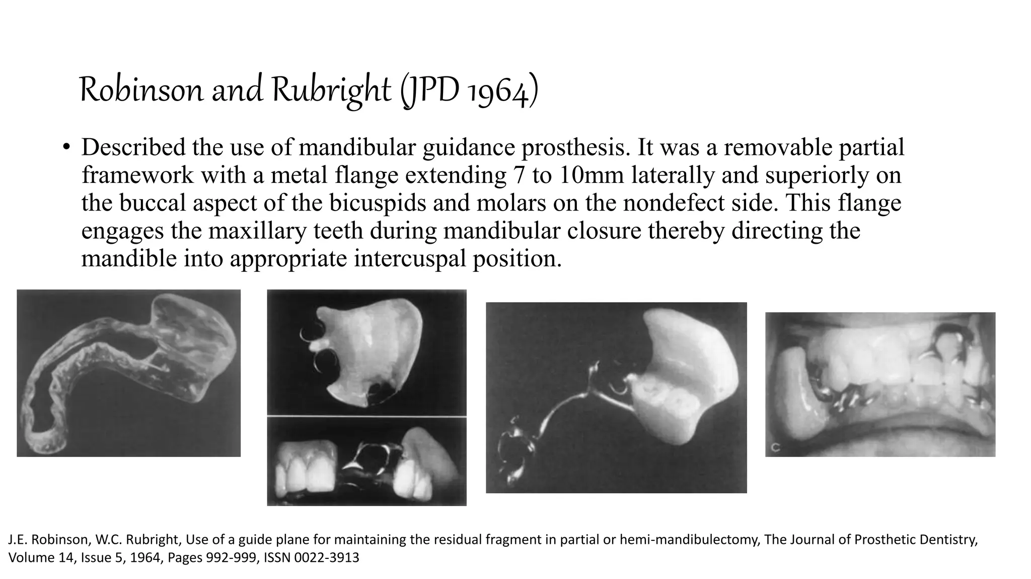 PROSTHODONTIC MANAGEMENT OF MANDIBULAR DEFECTS.pptx