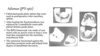 PROSTHODONTIC MANAGEMENT OF MANDIBULAR DEFECTS.pptx