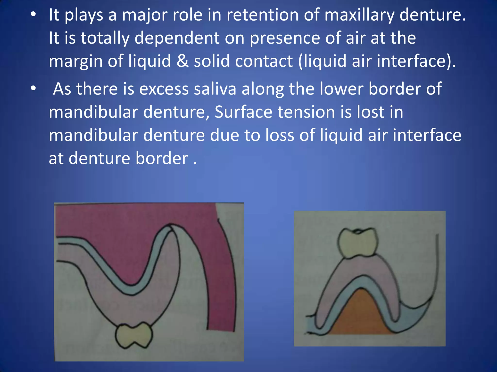 impression techniques of complete denture