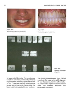 Prosthodontics clinical practice