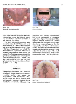 SEVERE UNILATERAL CLEFT LIP AND PALATE                                                         1 93




Figure 1 7.20                                   Figure 17.21
Final tooth preparation-mandible                Facebow registration




 removable gold foil prosthesis was then        concerned about esthetics. The treatment
 made to seal the oronasal fistula by attach-   was further complicated by the severe
 i ng it to the fixed prosthesis by means of    Angle class III jaw relationships and the
the precision attachment.                       negative overbite and overjet. Another
    Full arch polyether impressions were        problem was that the patient had no under-
made for tissue detail. The models were         standing of good oral hygiene. Due the
then mounted on a Hanau articulator with        decision after consultation with the plastic
the aid of a facebow registration (Figure       surgery and oral and maxillofacial surgery
 17.21) and the porcelain was baked. The        departments, that additional surgery would
final and minute adjustments of the biscuit-    not contribute to the success of the treat-
bake porcelain were carried out in the          ment and would only cause more trauma
mouth. The final glaze was applied to the       to the patient, surgery was not performed.
prostheses, and they were cemented with
Temp-Bond for a period of 2 weeks. They
were then cemented with zinc oxyphos-
phate cement for permanent cementation
(Figures 17.22-17.26).



                   SUMMARY

The patient presented with a severe
problem of unilateral cleft lip and palate,
remaining residual roots, caries, and
malpositioned teeth. There was a patho-
logic occlusion with serious balancing side
and protrusive premature contacts during        Figure 17.22
mandibular movements. He was very               Gold foil obturator to close palatal cleft
 