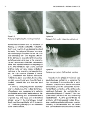 Prosthodontics in clinical practice | PDF