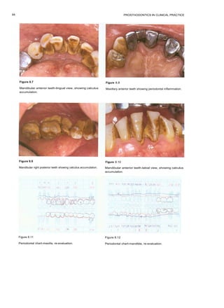Prosthodontics in clinical practice