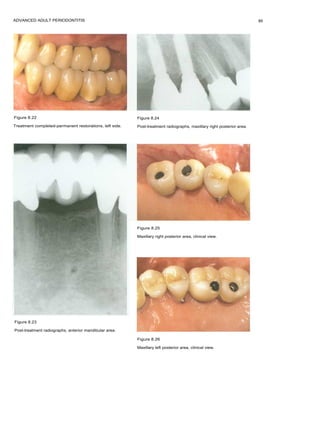 Prosthodontics in clinical practice