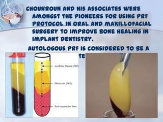 Advanced Bone grafting procedures in dental implant surgery | PPTX