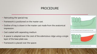 Functional impression in RPD | PPTX