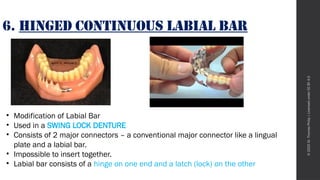 Mandibular Major Connectors - Prosthodontics Seminar.pptx