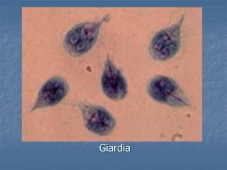 Giardia
 