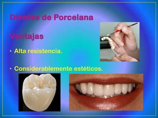 • Alta resistencia.

• Considerablemente estéticos.
 