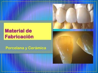 Porcelana y Cerámica
 