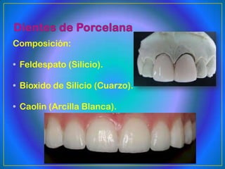 Composición:

• Feldespato (Silicio).

• Bioxido de Silicio (Cuarzo).

• Caolin (Arcilla Blanca).
 