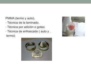 PMMA (termo y auto).
• Técnica de la laminado.
• Técnica por adición o goteo.
• Técnica de enfrascado ( auto y .
termo)
 