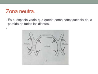 Zona neutra.
• Es el espacio vacío que queda como consecuencia de la
perdida de todos los dientes.
•
 