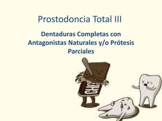 Prostodoncia Total III
Dentaduras Completas con
Antagonistas Naturales y/o Prótesis
Parciales
 