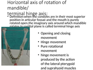 Mandibular Lateral Rotation Comprehensive Guide to Maxillary and Mandibular Impressions, Casts, and ...