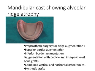 Comprehensive Guide to Maxillary and Mandibular Impressions, Casts, and ...