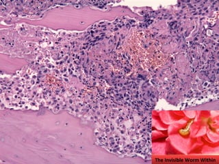 The Invisible Worm Within