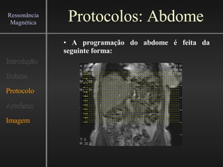 Protocolos: Abdome Introdução Bobina Protocolo Artefatos Imagem Ressonância Magnética A programação do abdome é feita da seguinte forma:   