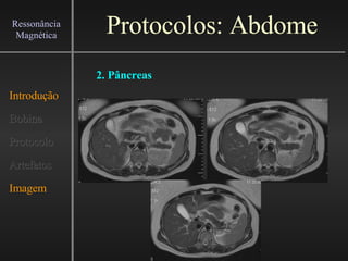Protocolos: Abdome Introdução Bobina Protocolo Artefatos Imagem Ressonância Magnética 2. Pâncreas 