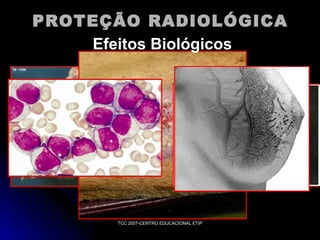 PROTEÇÃO RADIOLÓGICA
Efeitos Biológicos

TCC 2007-CENTRO EDUCACIONAL ETIP

 