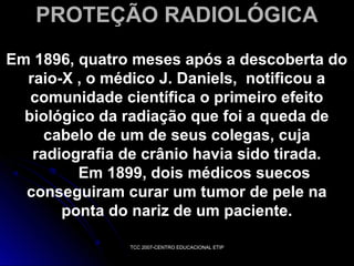 PROTEÇÃO RADIOLÓGICA
Em 1896, quatro meses após a descoberta do
raio-X , o médico J. Daniels, notificou a
comunidade científica o primeiro efeito
biológico da radiação que foi a queda de
cabelo de um de seus colegas, cuja
radiografia de crânio havia sido tirada.
Em 1899, dois médicos suecos
conseguiram curar um tumor de pele na
ponta do nariz de um paciente.
TCC 2007-CENTRO EDUCACIONAL ETIP

 