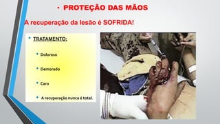 • TRATAMENTO:
• Doloroso
• Demorado
• Caro
• A recuperação nunca é total.
A recuperação da lesão é SOFRIDA!
• PROTEÇÃO DAS MÃOS
 