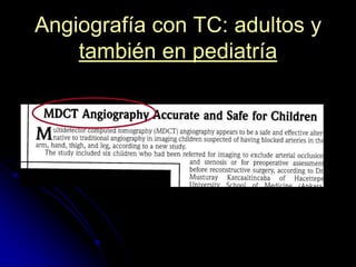 Angiografía con TC: adultos y
también en pediatría

 