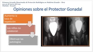 Aplicado confiar esculpir Proteccion radiologica en exploraciones a pacientes pediatricos - Sandra  Aguilar